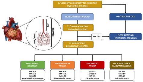 myocardial ischemia treatment guidelines.